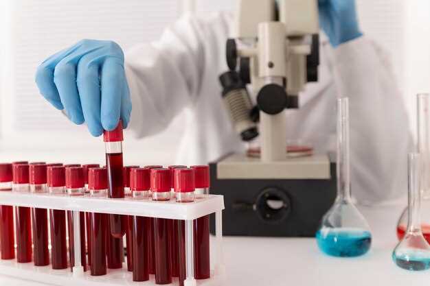Уровень гемоглобина определяется путем проведения общего анализа крови, где измеряется количество гемоглобина в единице объема крови.