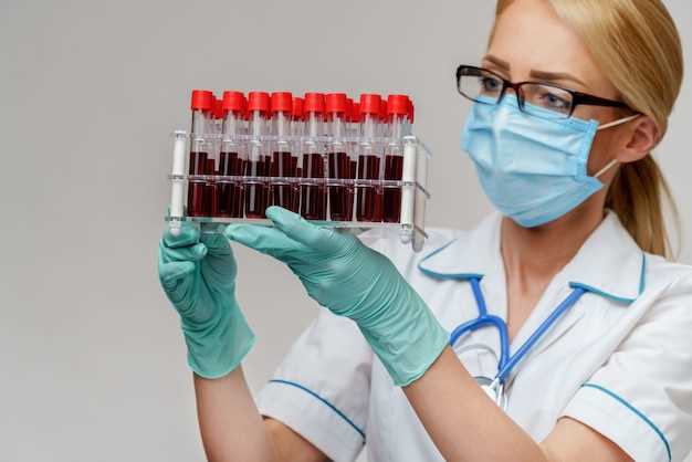 Как правильно подготовиться к сдаче анализа крови на биохимические показатели