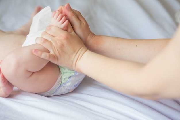 Почему возникает пупочная грыжа у новорожденных?