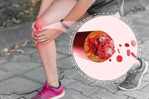 Как облегчить боль и предотвратить повреждение колена