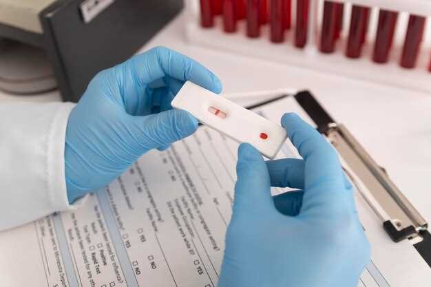 Как проводится анализ на НСТ показатель крови?